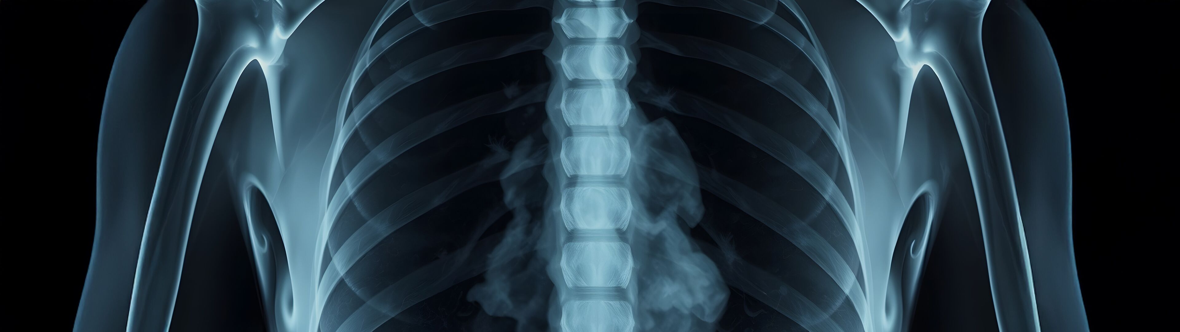 Weichteilverkalkung DTZ Therapie GbR