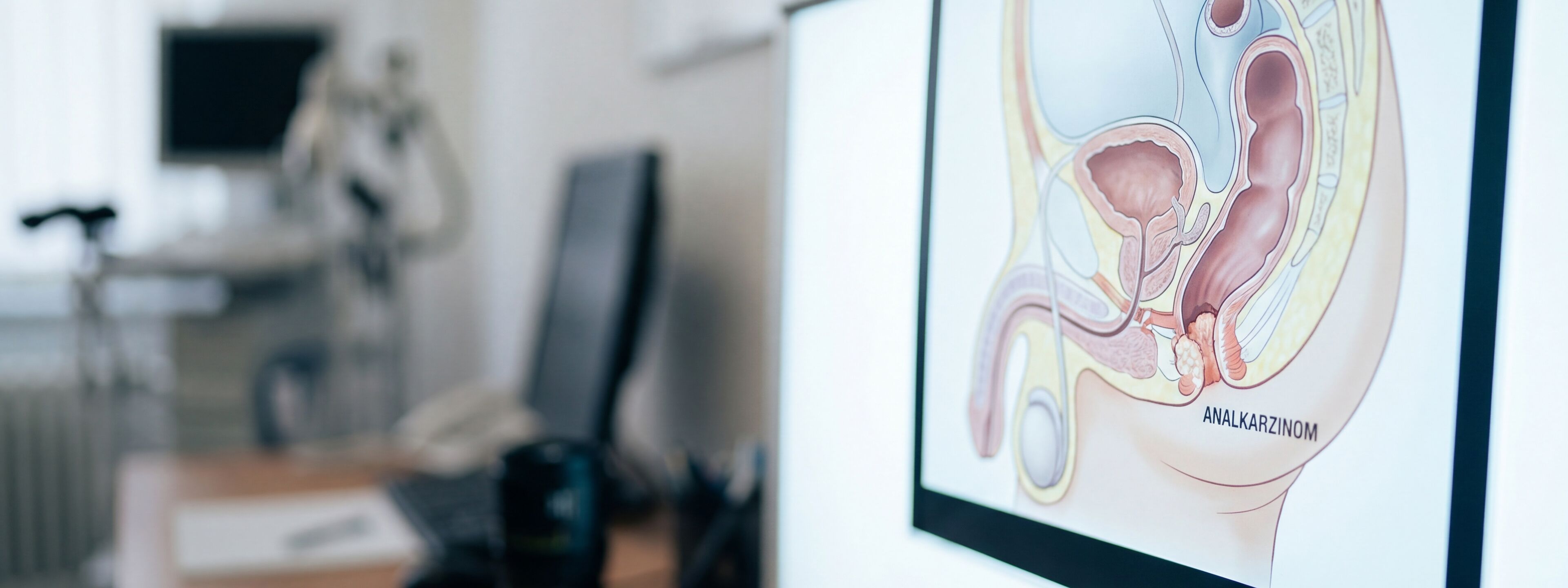 Strahlentherapie Analkarzinom Berlin DTZ Therapie GbR