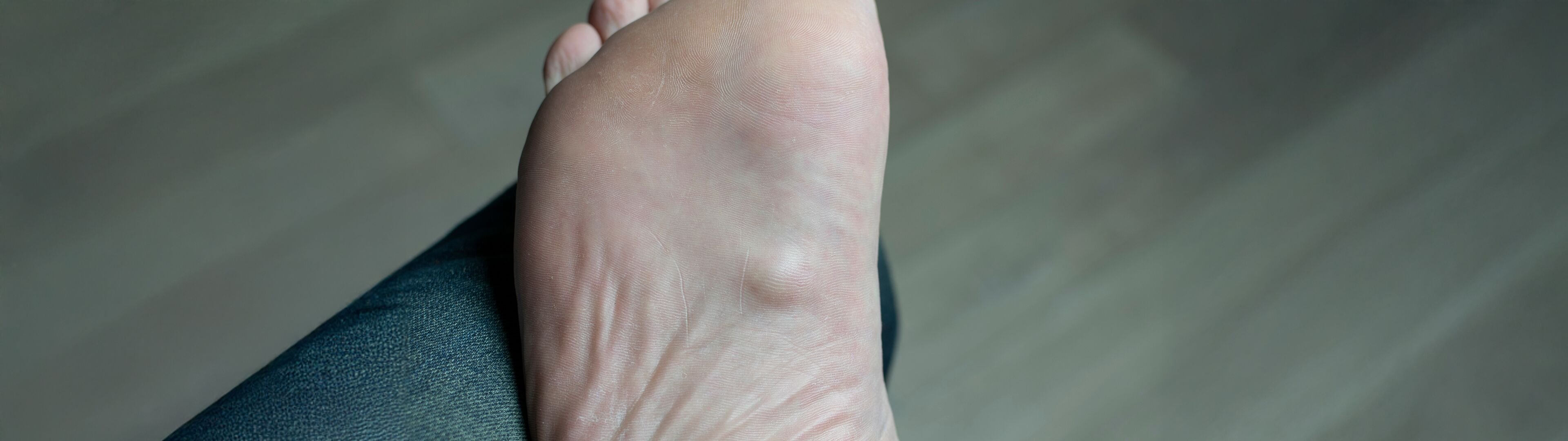 Morbus Ledderhose DTZ Therapie GbR